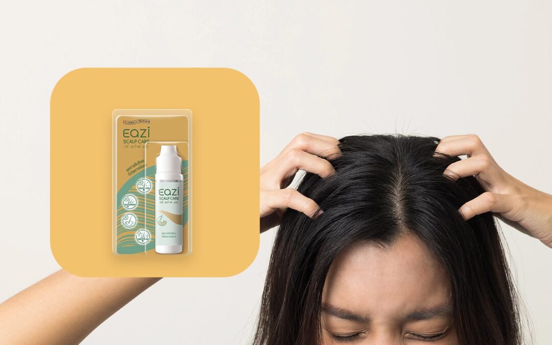 ลดอาการ “คันหนังศีรษะ” ด้วย EAZI SCALP CARE