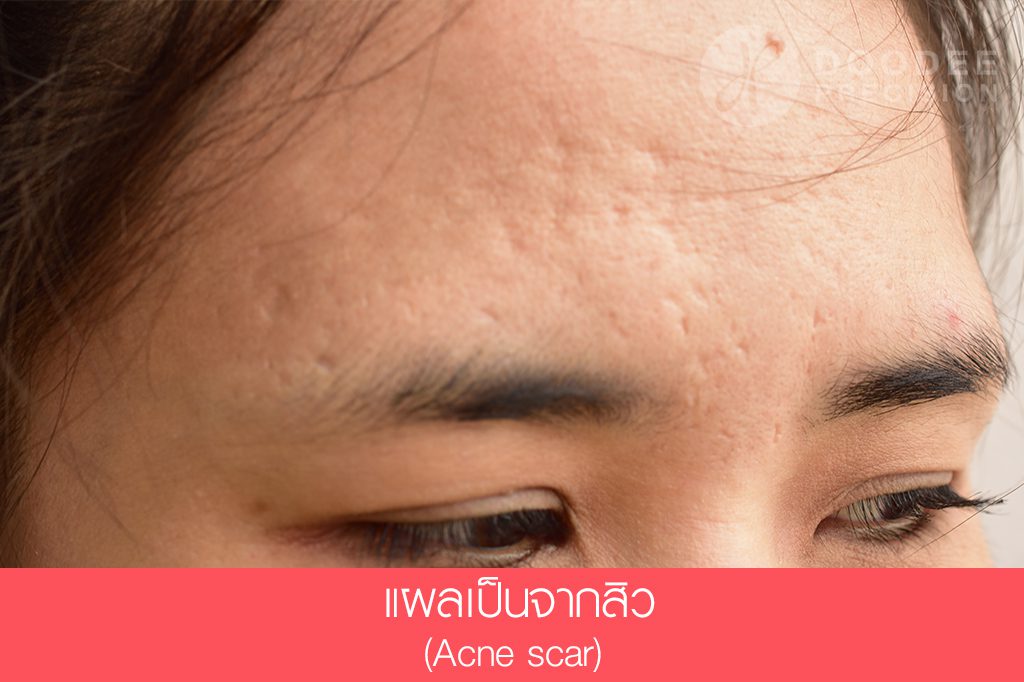 PAN Pcosmed ศูนย์รวมโซลูชั่นด้านผิวหนังครบวงจร