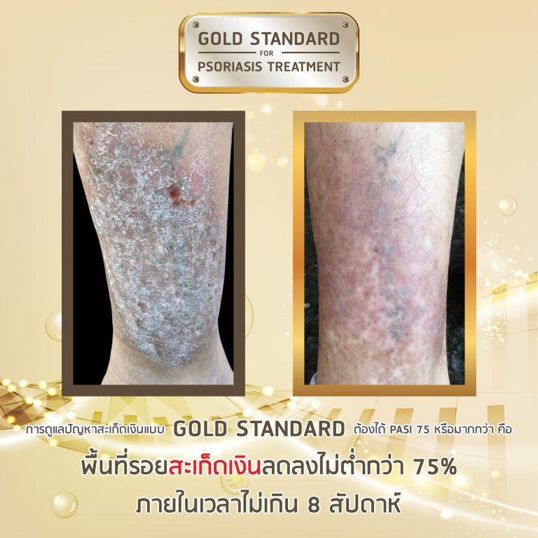 PAN Pcosmed ศูนย์รวมโซลูชั่นด้านผิวหนังครบวงจร