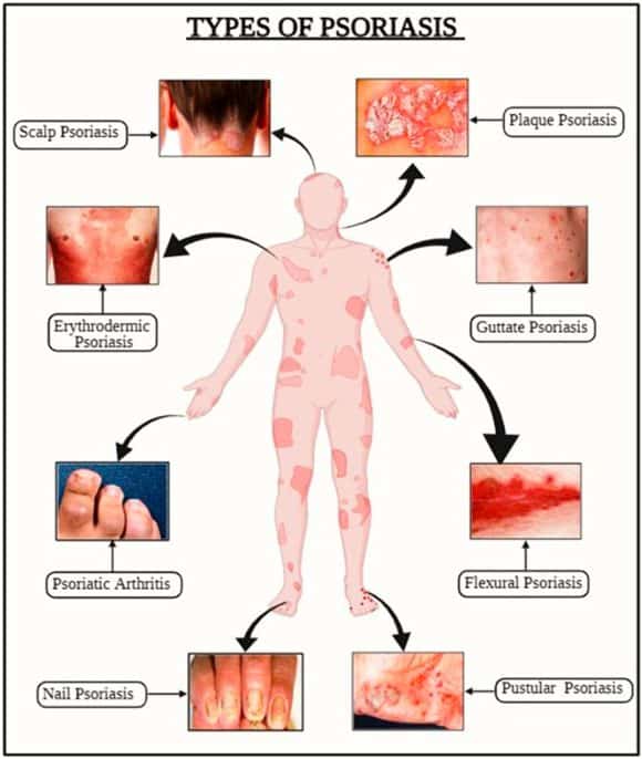 PAN Pcosmed ศูนย์รวมโซลูชั่นด้านผิวหนังครบวงจร