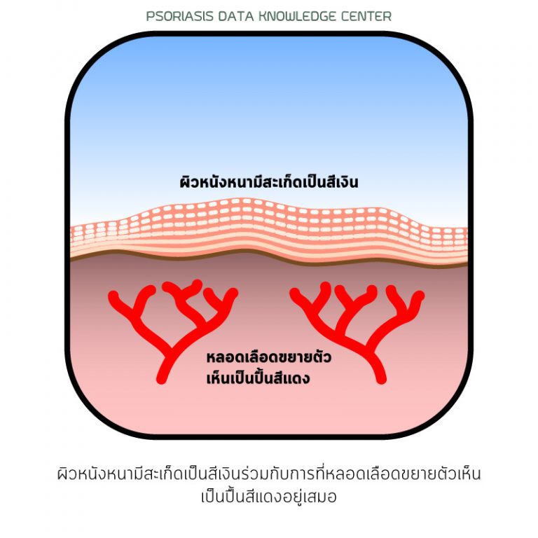 PAN Pcosmed ศูนย์รวมโซลูชั่นด้านผิวหนังครบวงจร