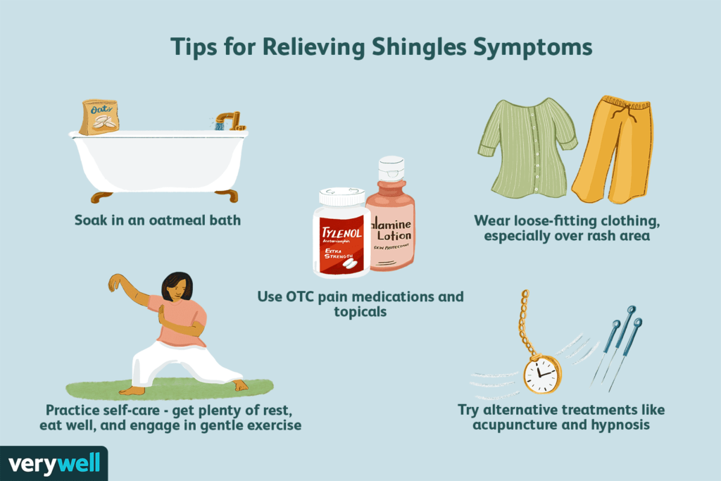 งูสวัด Shingles คำแนะนำสำหรับผู้ป่วยงูสวัด PAN Pcosmed ศูนย์รวมโซลูชั่นด้านผิวหนังครบวงจร