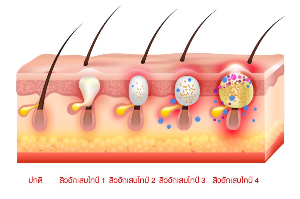 PAN Pcosmed ศูนย์รวมโซลูชั่นด้านผิวหนังครบวงจร