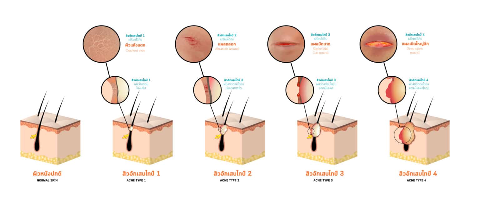 PAN Pcosmed ศูนย์รวมโซลูชั่นด้านผิวหนังครบวงจร