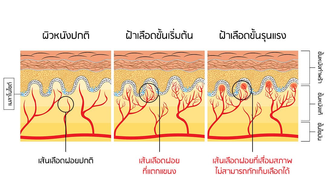 PAN Pcosmed ศูนย์รวมโซลูชั่นด้านผิวหนังครบวงจร