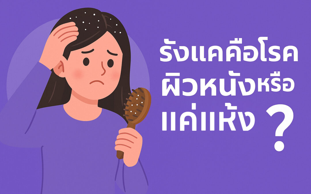 รังแคคือโรคผิวหนังหรือแค่แห้ง?