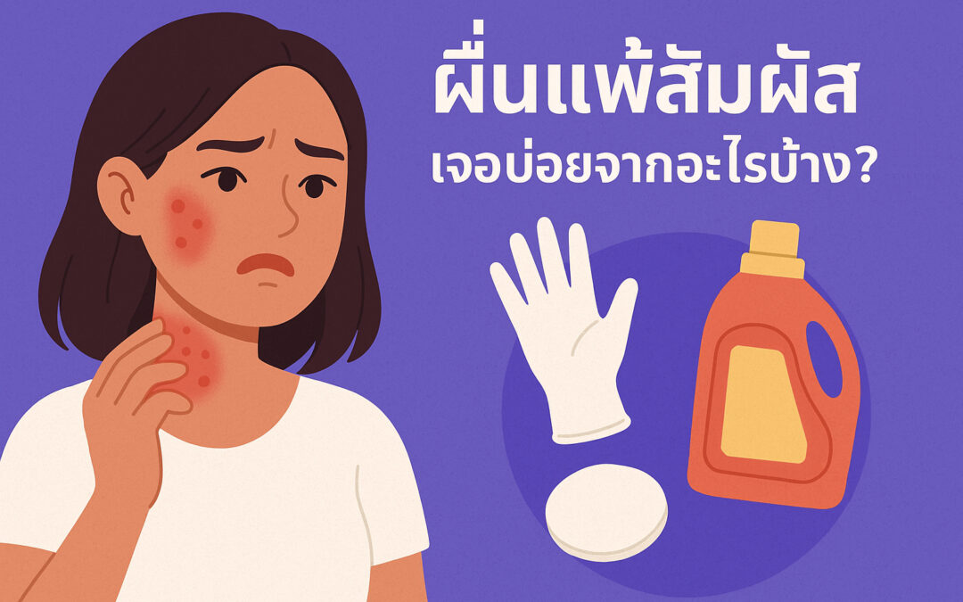 ผื่นแพ้สัมผัส – เจอบ่อยจากอะไรบ้าง?
