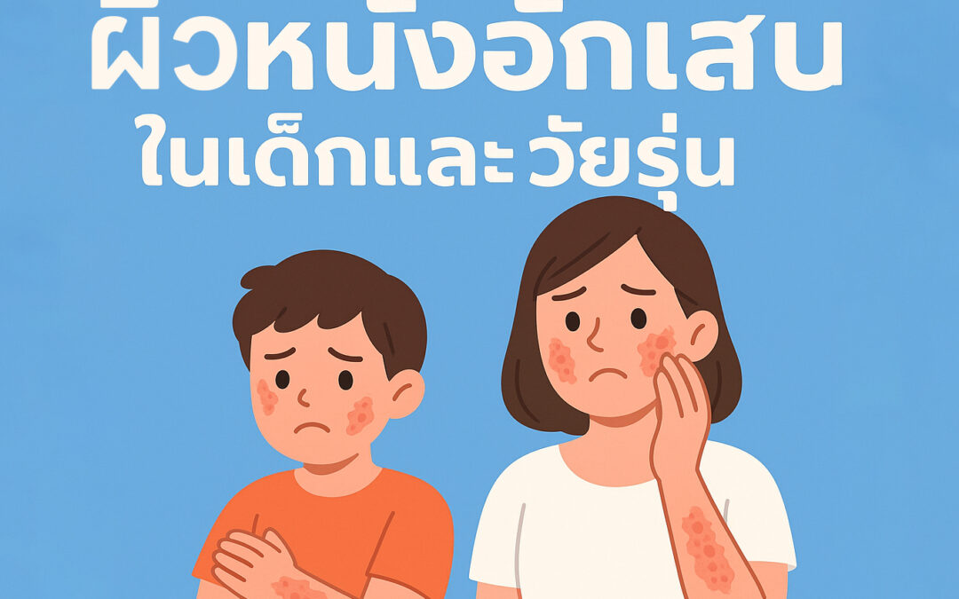 ผิวหนังอักเสบในเด็กและวัยรุ่น
