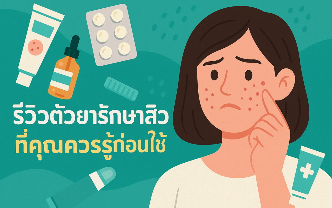 รีวิวตัวยารักษาสิวที่คุณควรรู้ก่อนใช้