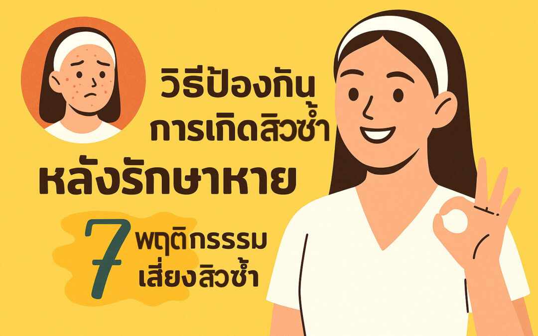 วิธีป้องกันการเกิดสิวซ้ำหลังรักษาหาย