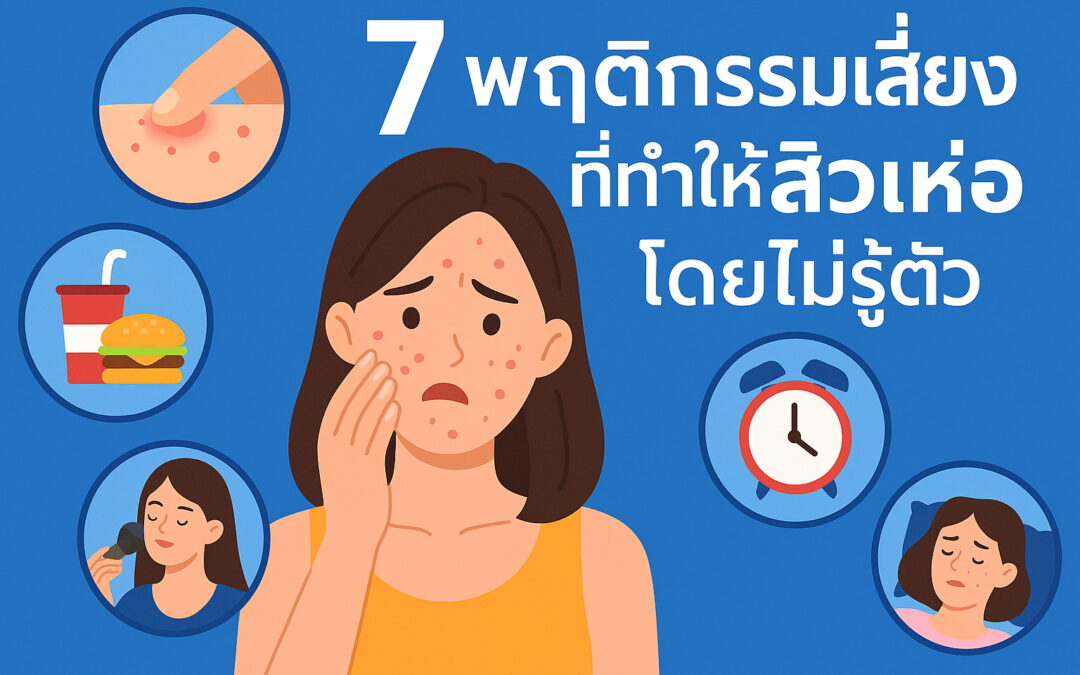7 พฤติกรรมเสี่ยงที่ทำให้สิวเห่อโดยไม่รู้ตัว