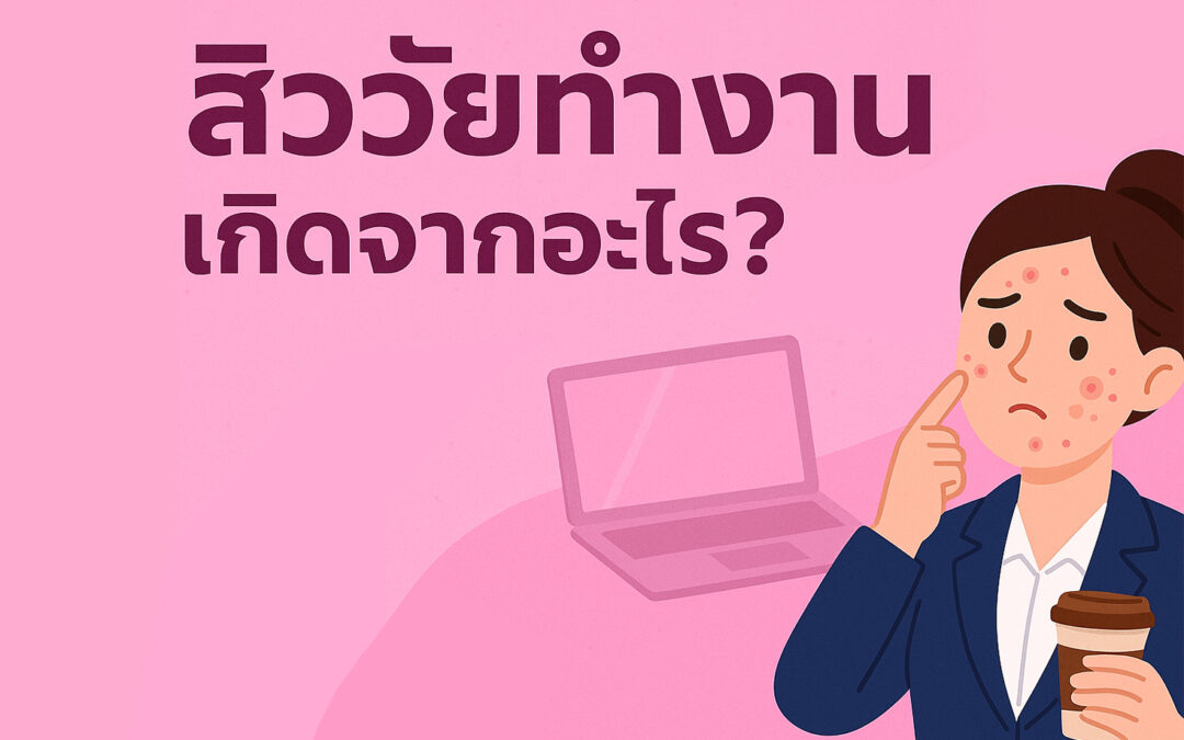 สิววัยทำงานเกิดจากอะไร? ปรับไลฟ์สไตล์อย่างไรให้ผิวกลับมาใส