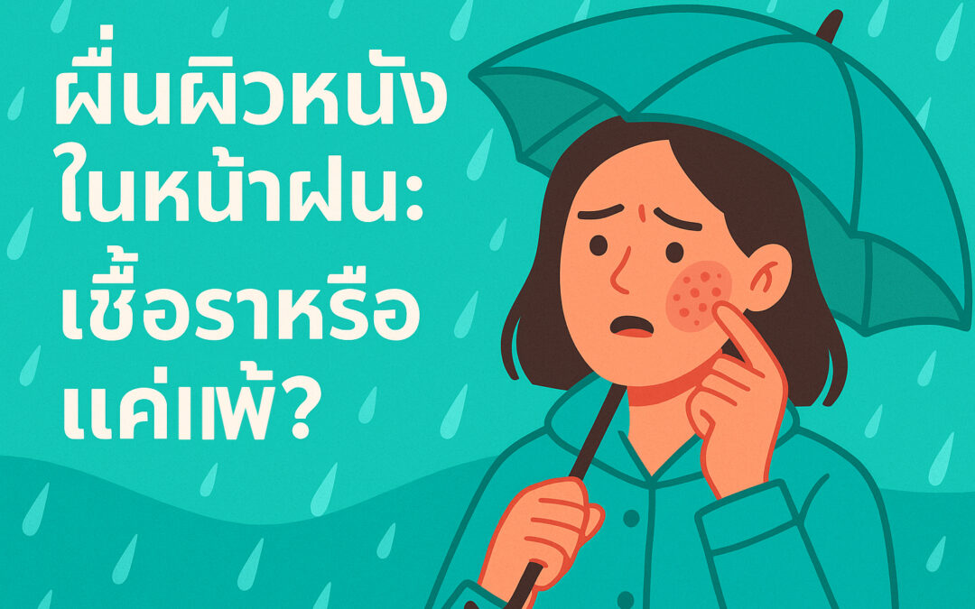 ผื่นผิวหนังในหน้าฝน: เชื้อราหรือแค่แพ้?